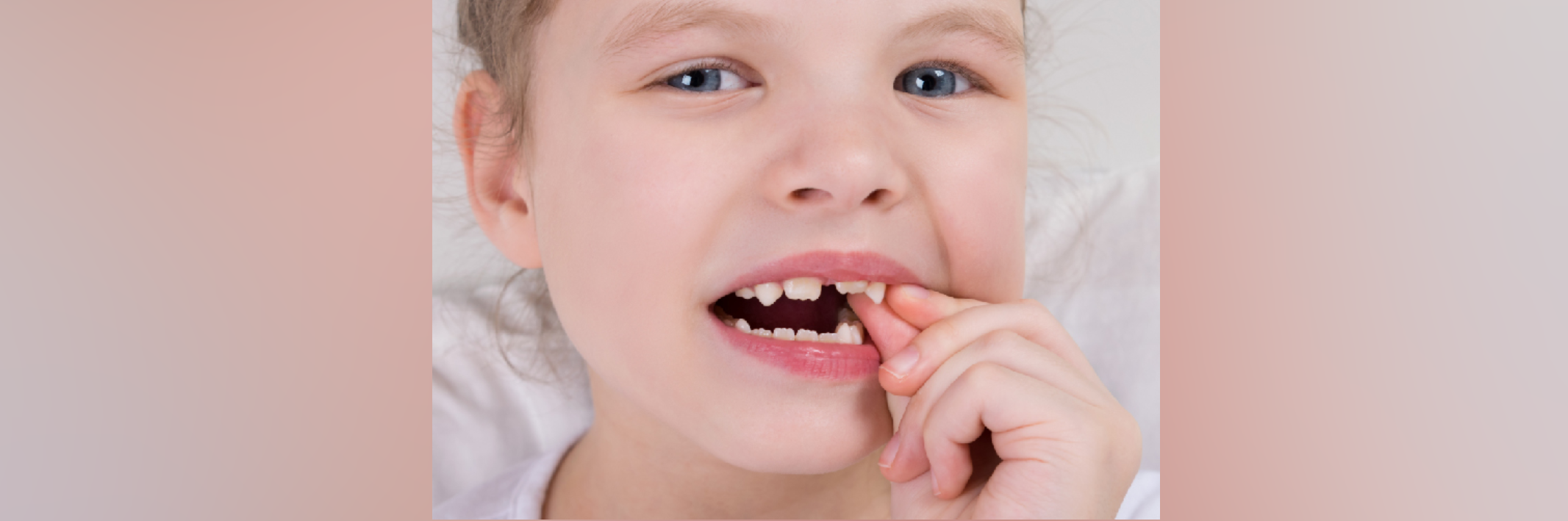 What To Expect After A Baby Tooth Extraction