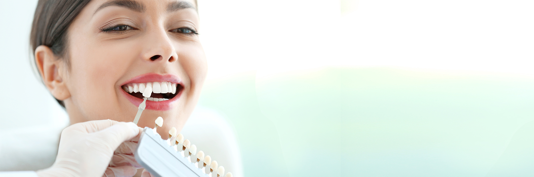 The Facts You Need to Know About Dental Veneers