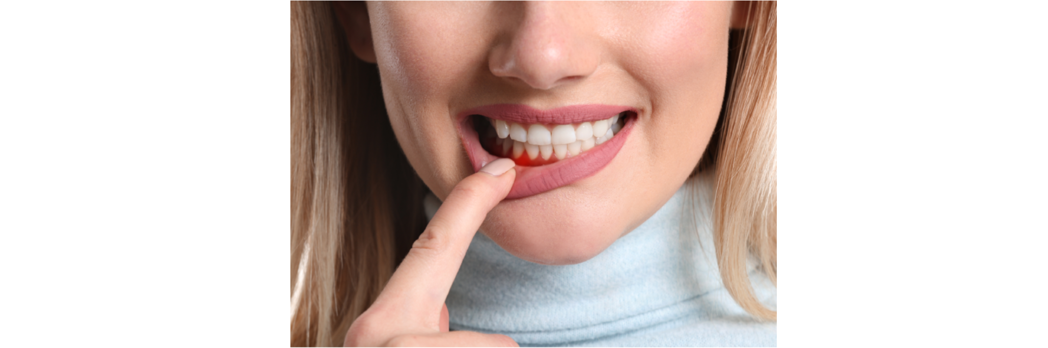How Is Gum Disease Treated?